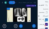 وبینار«مشکلات و بیماری هاى شایع پرده جنب (پلور) در کودکان» در دانشگاه علوم پزشکی گیلان برگزار شد