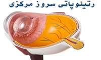 زمان برگزاری وبینار«کوروید رتینوپاتی سروز مرکزی (CSCR)» در دانشگاه علوم پزشکی گیلان اعلام شد