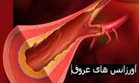 زمان برگزاری وبینار "اورژانس های عروق" در دانشگاه علوم پزشکی گیلان اعلام شد