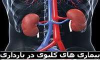 وبینار "بیماری های کلیوی در بارداری" را برگزار می کند