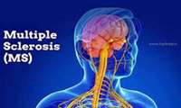زمان برگزاری وبینار آموزشی "MS" در دانشگاه علوم پزشکی گیلان اعلام شد